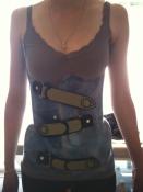 Pose de corsets orthopédiques Pose de corsets orthopédiques