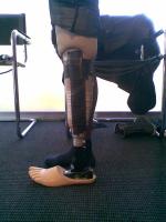 prothèse jambe gauche
